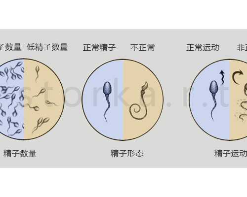 试管ep方案 试管婴儿ep方案是什么意思,代生地址电话