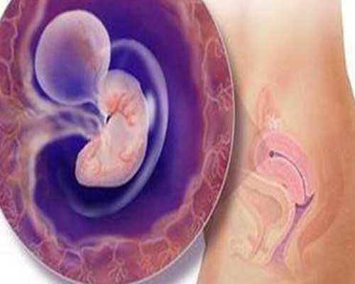 做试管婴儿能避免狐臭遗传吗！试管婴儿可以防止遗传病吗！,代怀产子价格